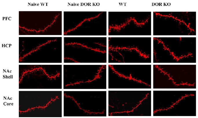Figura cedida per NeuroPhar