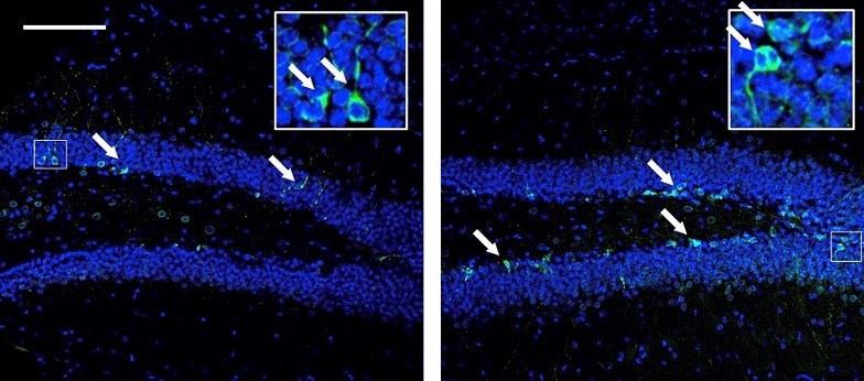 Confocal microscopy image of the dentate gyrus (hippocampus). The green mark indicates the neuronal differentiation, which is higher in the sample of animals treated with cannabidiol