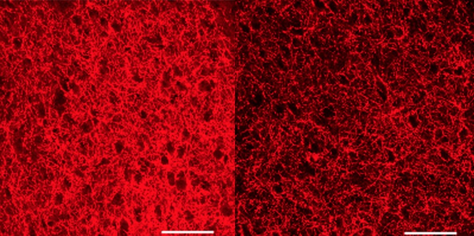 L'exposició prolongada a un cannabinoide sintètic incrementa l'expressió del receptor cannabinoide tipus 1. Imatge inicial - L'exposició prolongada a un cannabinoide sintètic incrementa l'expressió del receptor cannabinoide tipus 1.
